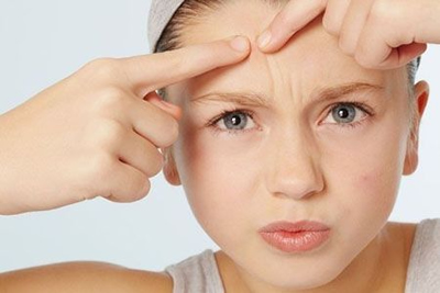 痘痘 祛痘 LRDIY 小资生活 坏习惯 化妆品品牌