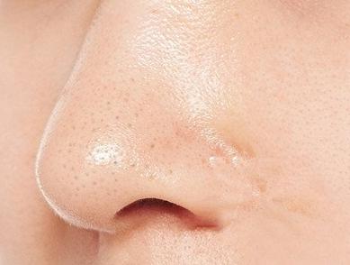 泰国white 女皇生活 去黑头套盒 去黑头泰国 white去黑头 white芦